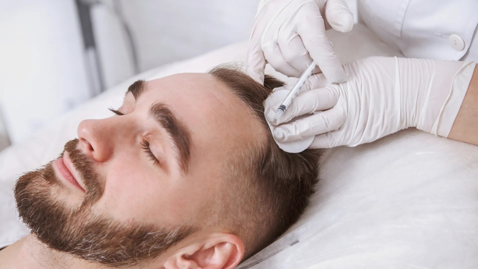 PDO Threads and PRP for Hair Restoration Picture