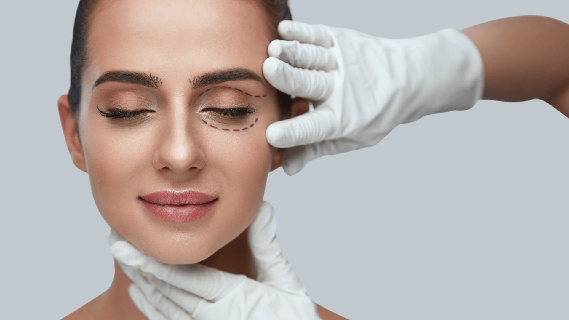 Scarless Blepharoplasty with Plexr by Dr. Maryam Hekmat Picture