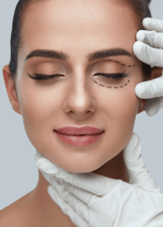 Scarless Blepharoplasty with Plexr by Dr. Maryam Hekmat Picture