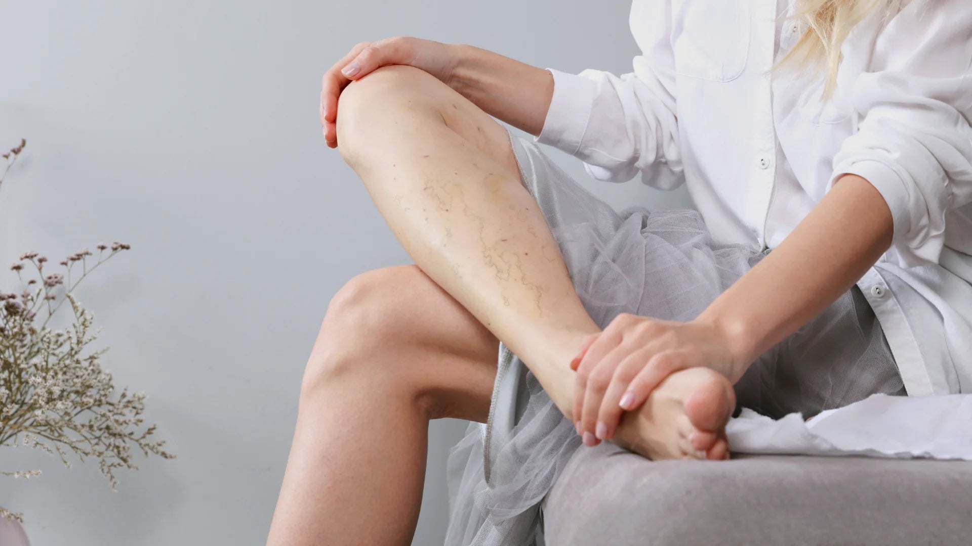 Sclerotherapy for Physicians & Nurses—Online Training Picture